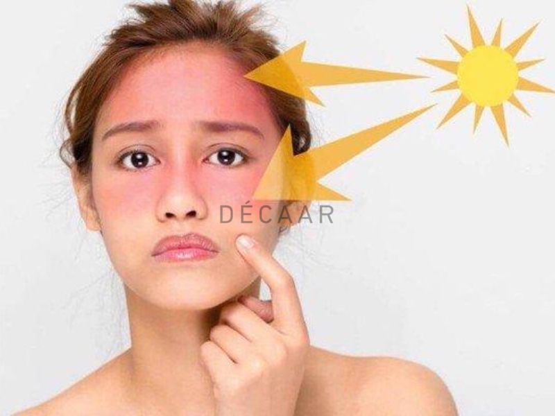 nên peel da trước hay sau khi đi biển